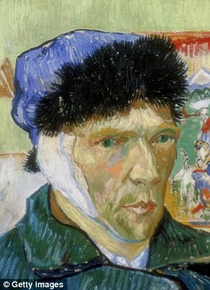 Giai ma “so phan” cai tai bi cat cua Vincent van Gogh-Hinh-2